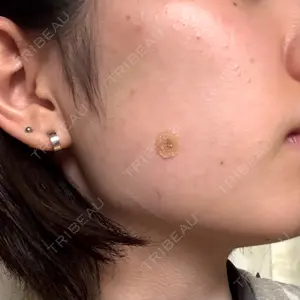 KARIS beauty clinic口コミ