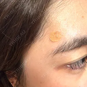 KARIS beauty clinic口コミ