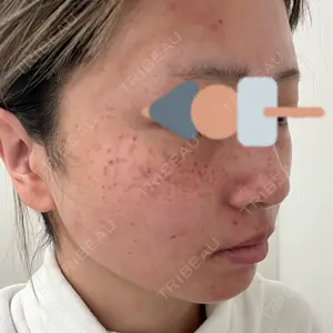 やさしい美容皮膚科・皮フ科 やさしい美容皮膚科・皮フ科　秋葉原院口コミ