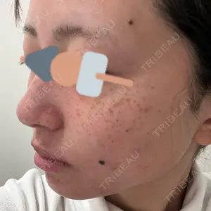 やさしい美容皮膚科・皮フ科 やさしい美容皮膚科・皮フ科　秋葉原院口コミ