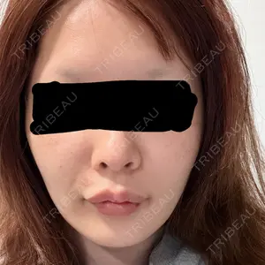 X CLINIC X CLINIC 恵比寿院口コミ