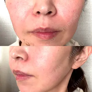 東京美容皮膚科アロエクリニック 東京美容皮膚科アロエクリニック池袋口コミ