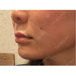 アイビークリニック 千葉美容外科アイビークリニック口コミ