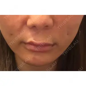 アイビークリニック 千葉美容外科アイビークリニック口コミ