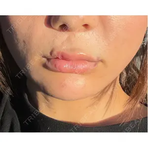 アイビークリニック 千葉美容外科アイビークリニック口コミ