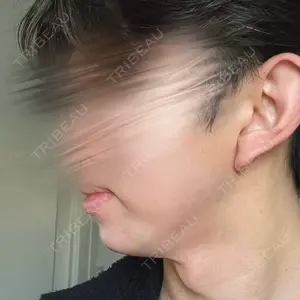 HAAB CLINIC HAAB×DREAM BEAUTY CLINIC 東京本院口コミ