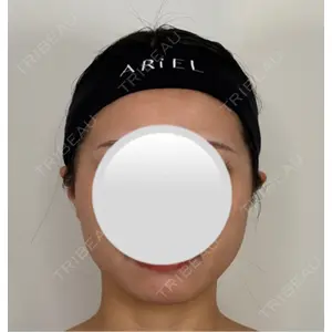 アリエル美容クリニック アリエル美容クリニック 水戸院口コミ