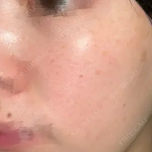 ルラ美容クリニック ルラ美容クリニック 横浜院口コミ