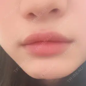 口コミ