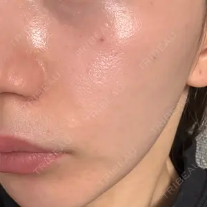 CHARIS BEAUTY CLINIC口コミ