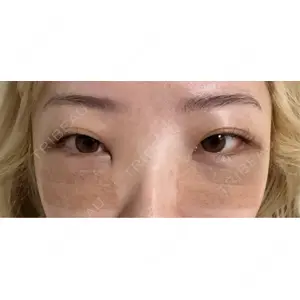 Nebula Clinic 新宿美容外科ネビュラクリニック口コミ