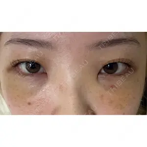 Nebula Clinic 新宿美容外科ネビュラクリニック口コミ