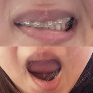 ビラビューティークリニック 博多美容外科/美容皮膚科 ビラビューティークリニック口コミ