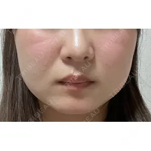 ビラビューティークリニック 博多美容外科/美容皮膚科 ビラビューティークリニック口コミ