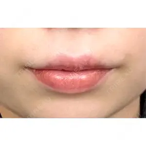 ビラビューティークリニック 博多美容外科/美容皮膚科 ビラビューティークリニック口コミ