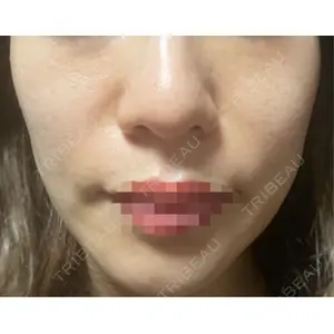 ビラビューティークリニック 博多美容外科/美容皮膚科 ビラビューティークリニック口コミ