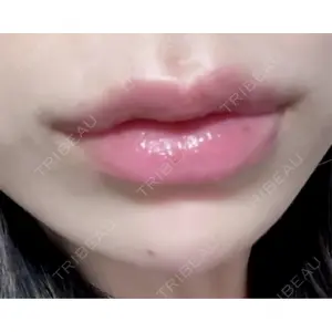 ルラ美容クリニック ルラ美容クリニック 大阪本院口コミ