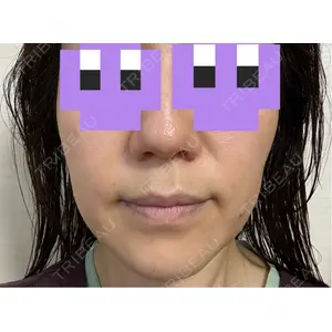 東京美容皮膚科アロエクリニック 東京美容皮膚科アロエクリニック池袋口コミ