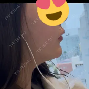 プロクリニック PRO CLINIC プロクリニック 銀座院口コミ