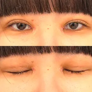 東京シンデレラ美容外科 東京シンデレラ美容外科 池袋院口コミ