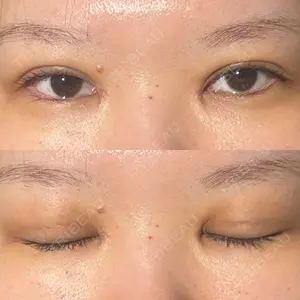 東京シンデレラ美容外科 東京シンデレラ美容外科 池袋院口コミ