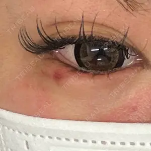 ルラ美容クリニック ルラ美容クリニック 横浜院口コミ