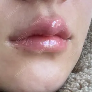 ルラ美容クリニック ルラ美容クリニック 大阪本院口コミ