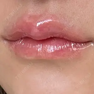 ルラ美容クリニック ルラ美容クリニック 大阪本院口コミ