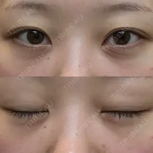 湘南美容クリニック 湘南美容クリニック 千葉センシティ院口コミ