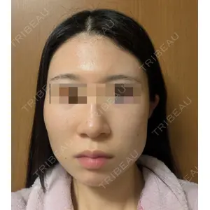 Belle Via Skin Clinic Belle Via Clinic口コミ