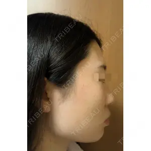 Belle Via Skin Clinic Belle Via Clinic口コミ