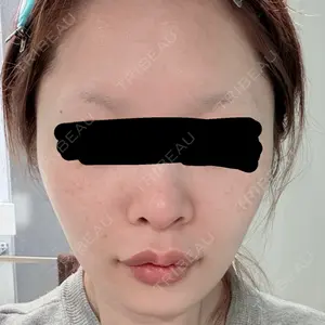 X CLINIC X CLINIC 恵比寿院口コミ