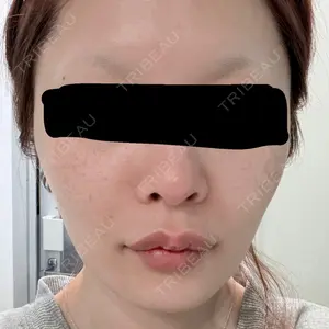 X CLINIC X CLINIC 恵比寿院口コミ