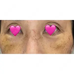 湘南美容クリニック 湘南美容クリニック 千葉センシティ院口コミ