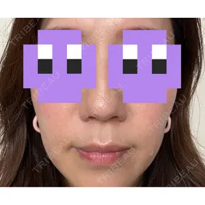 東京美容皮膚科アロエクリニック 東京美容皮膚科アロエクリニック池袋口コミ