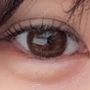 ルラ美容クリニック ルラ美容クリニック 渋谷本院口コミ