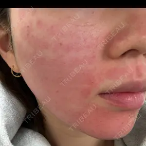 東京シルククリニック 東京シルククリニック 新宿院口コミ