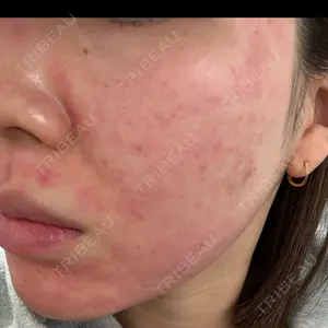 東京シルククリニック 東京シルククリニック 新宿院口コミ