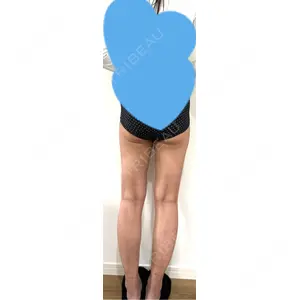 GAYA body design clinic口コミ