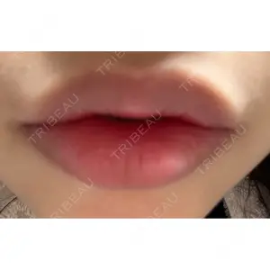 口コミ