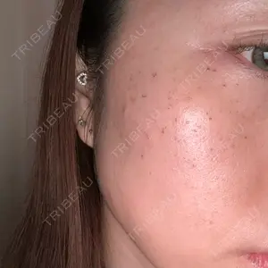 聖心美容クリニック グループ S-Laboクリニック 渋谷院口コミ