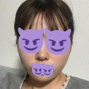 東京美容外科 東京美容外科 池袋院口コミ