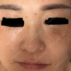 アサイクリニック 心斎橋本院口コミ