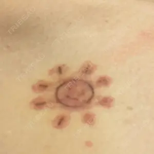 コスメディカルクリニック シンシア コスメディカルクリニック シンシア 銀座院口コミ