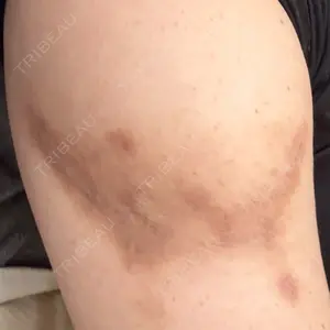 アサイクリニック 心斎橋本院口コミ