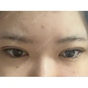 TCB東京中央美容外科 TCB東京中央美容外科 奈良院口コミ