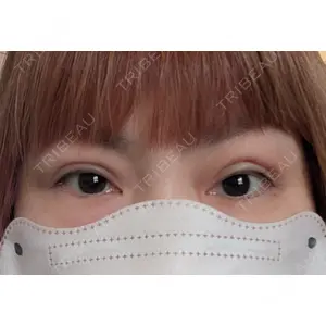 湘南美容クリニック 湘南美容クリニック 千葉センシティ院口コミ