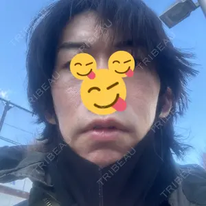 南青山コスメクリニック口コミ