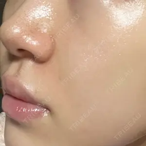 ルラ美容クリニック ルラ美容クリニック 大阪本院口コミ