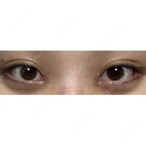 Nebula Clinic 新宿美容外科ネビュラクリニック口コミ